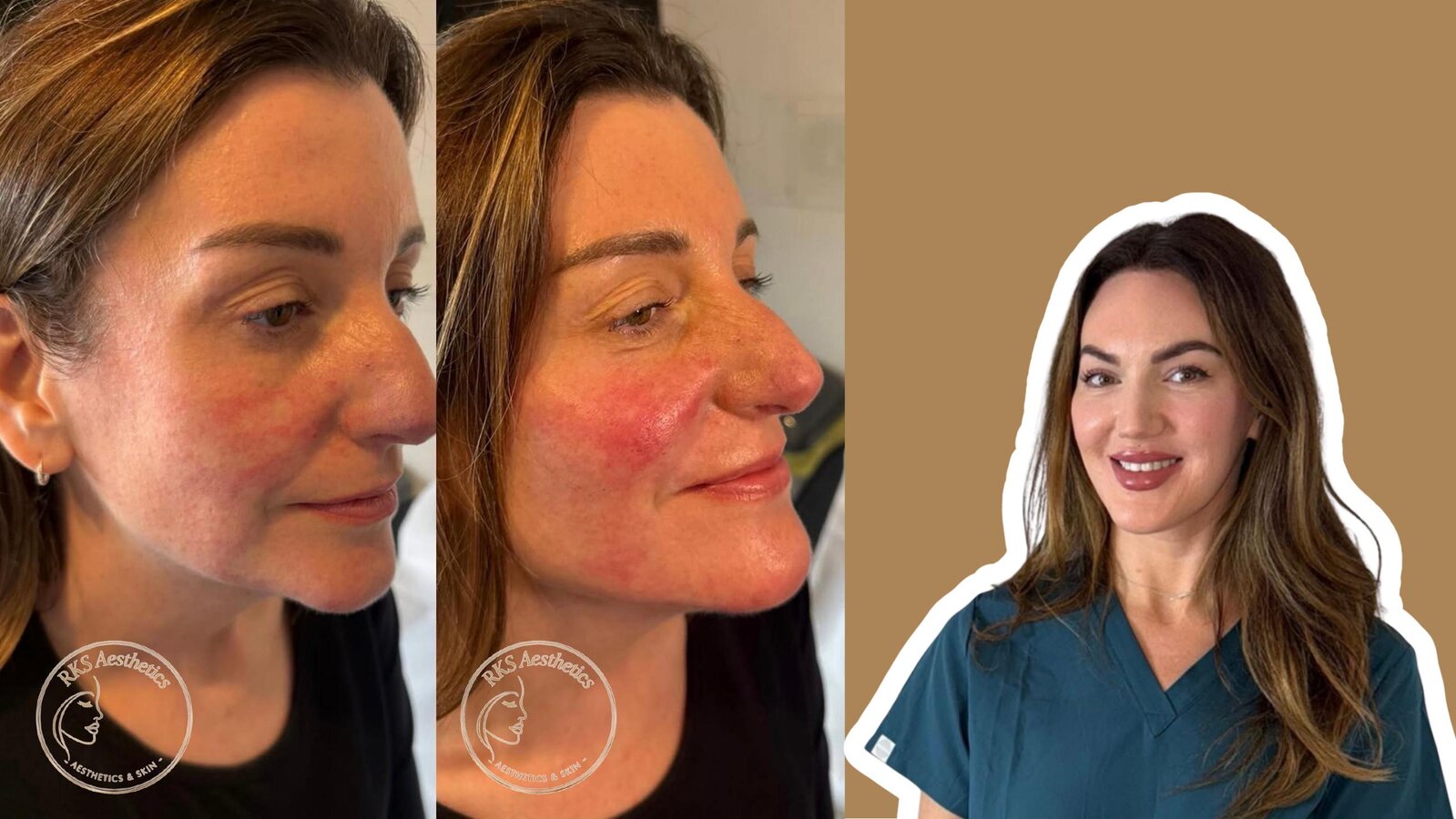 Clinical Expertise — RKS Aesthetics treatment layout